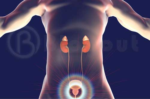 Bladder Cancer