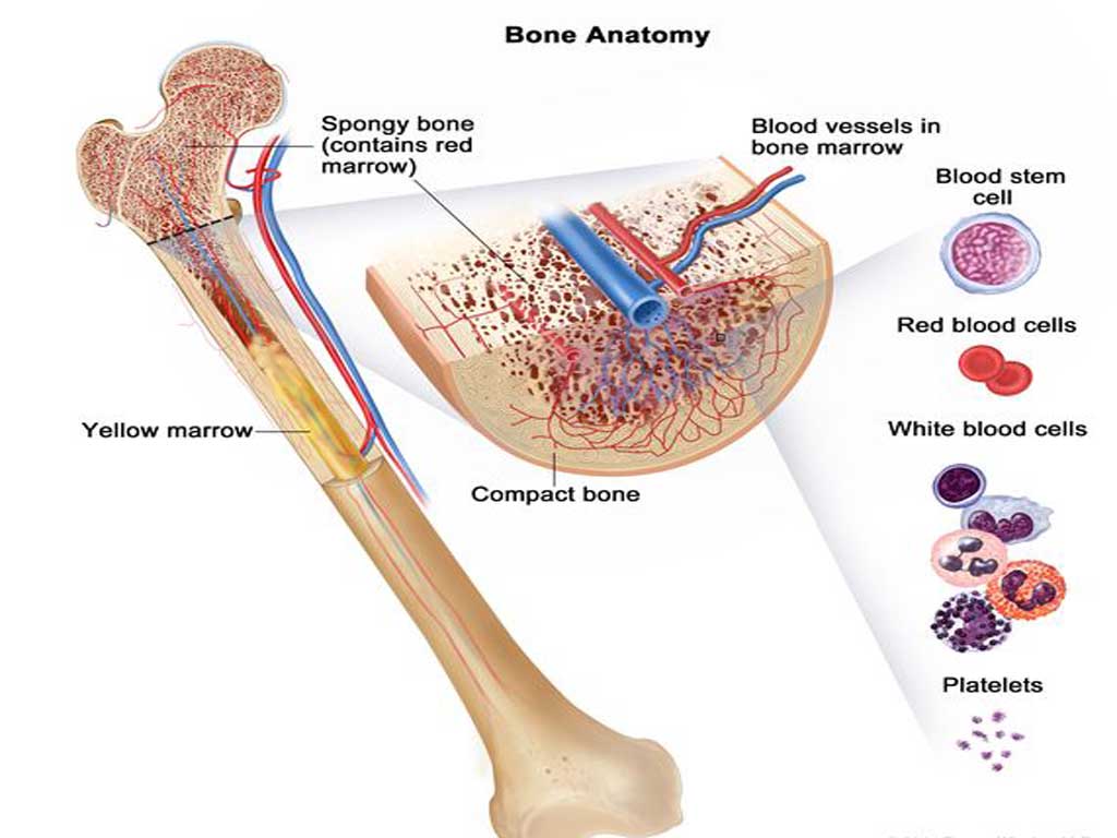 Bone Marrow Cancer