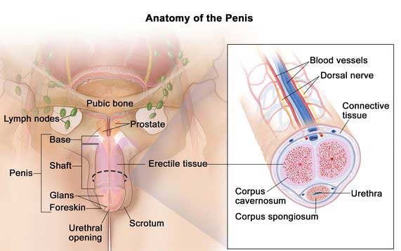 Penis Cancer